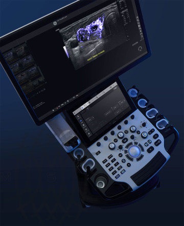 GE Logiq Fortis аппарат УЗИ