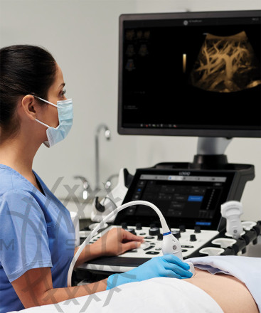 GE Logiq Fortis аппарат УЗИ