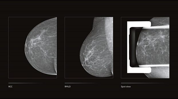 Цифровой маммограф GE Senographe Crystal Nova
